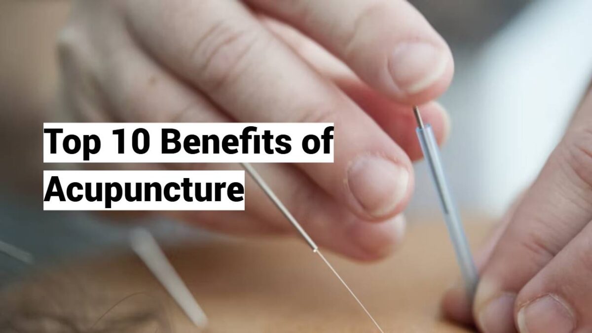 Top 10 Benefits of Acupuncture Top 10 Benefits of Acupuncture